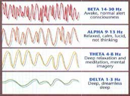 i-braininjuries.jpg i-braininjuries.jpg